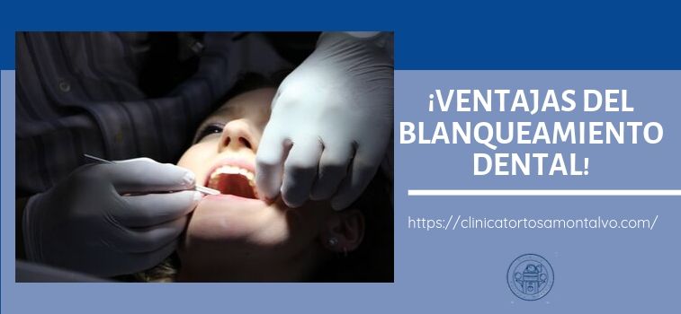 Blanqueamiento dental de Cádiz, Clínica Tortosa Montalvo