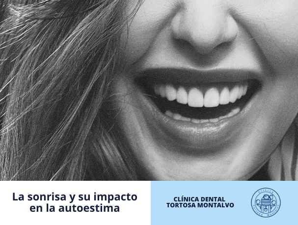 sonrisa-y-su-impacto-en-el-autoestima