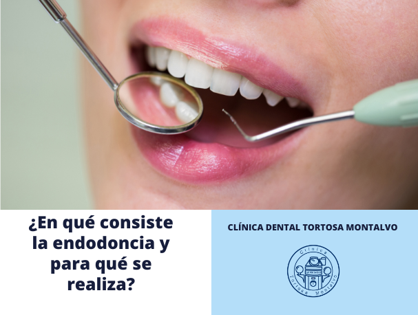 endodoncia-clinica-tortosa-montalvo