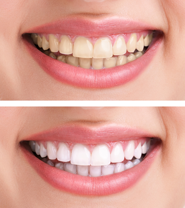 boca dientes blancos