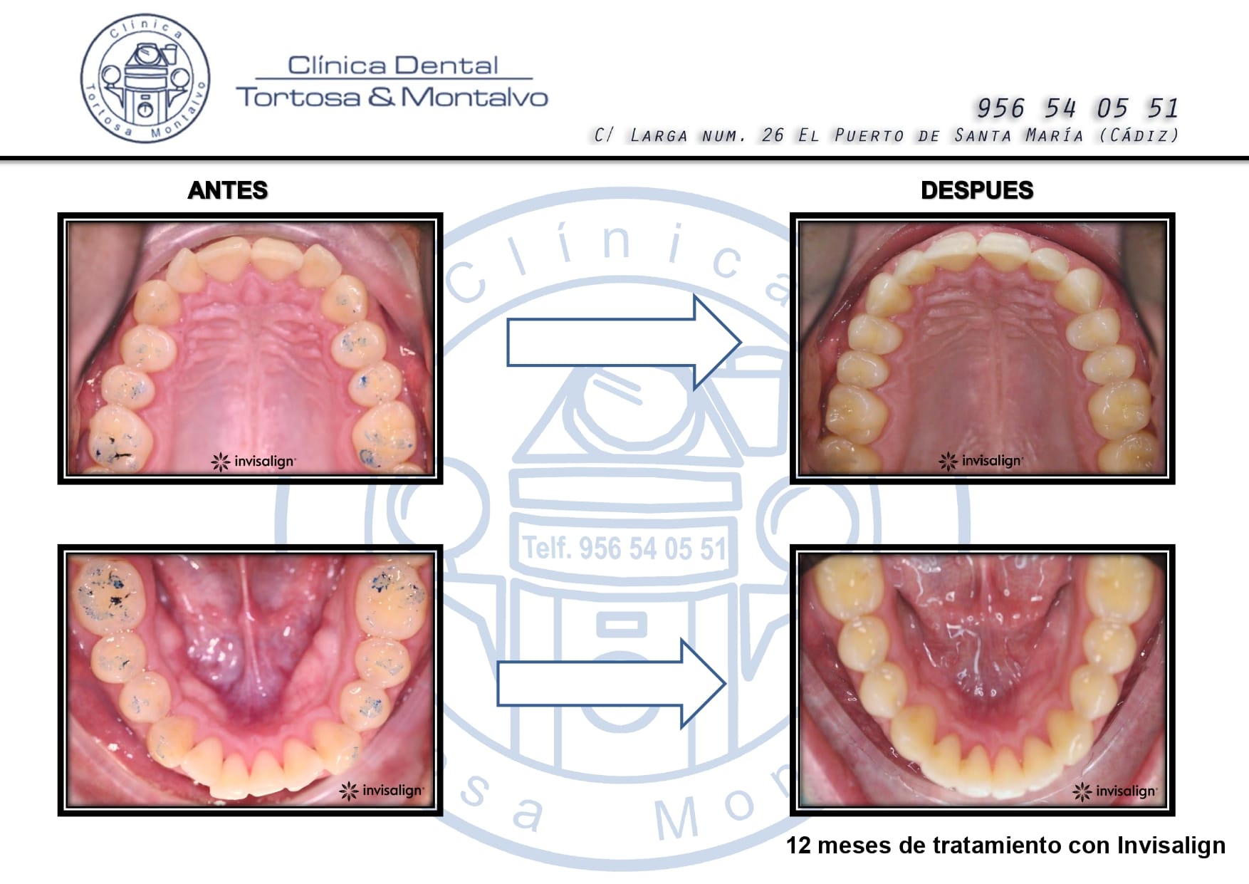 ortodoncia-clinica-tortosa