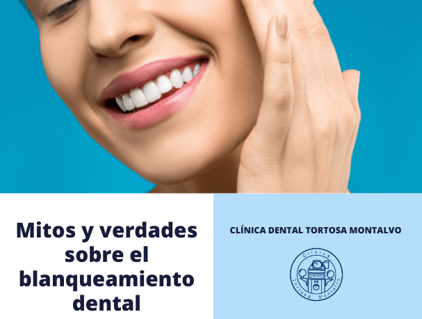 mitos y verdades del blanqueamiento dental